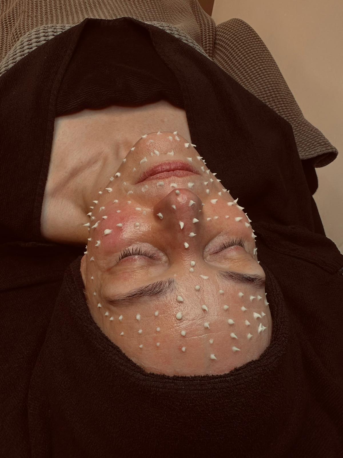 CellStory behandeling