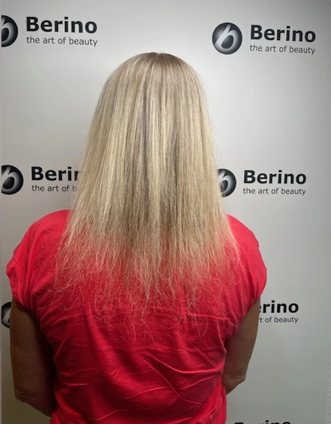 Berino Care Before and After 10