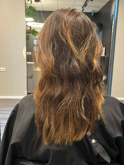 Berino Care Before and After 11